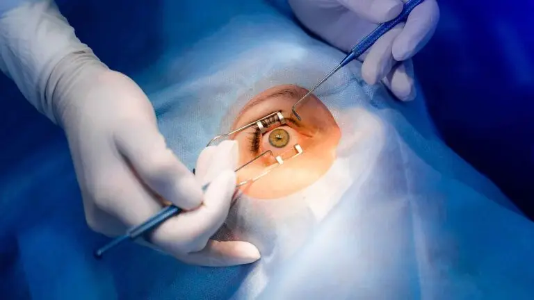 Fakik Göz İçi Lens Tedavisi