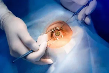 blog-image-223-768x432