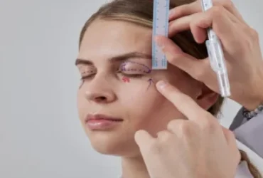 goz-kapagi-ameliyati-blefaroplasti goz-kapagi-ameliyati-blefaroplasti